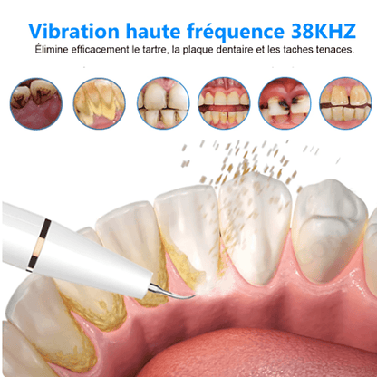 Détartreurs Dentaires Électriques et Ultrasons